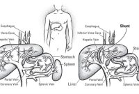 What Are The Benefits Of Probiotics For Digestion